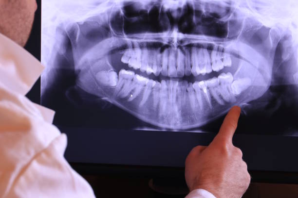 Best Emergency Dental Surgery in Naranja, FL