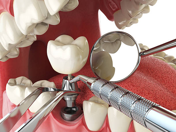 Best Emergency Broken Tooth Repair in Naranja, FL